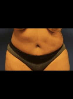 After Image