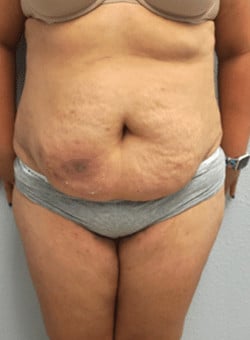 Before Image