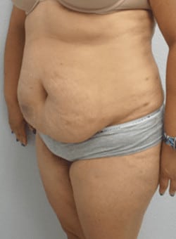 Before Image