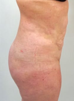 After Image