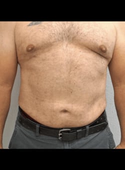 After Image