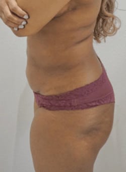 After Image