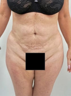 After Image