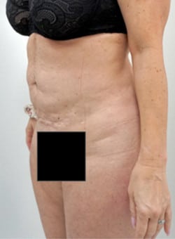 After Image