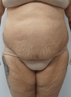 After Image