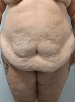 Before Image