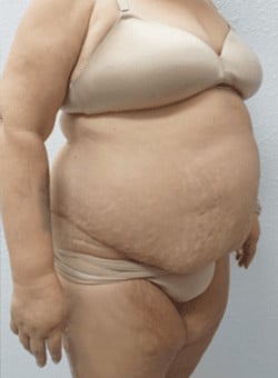 After Image