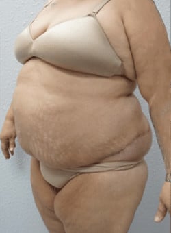 After Image