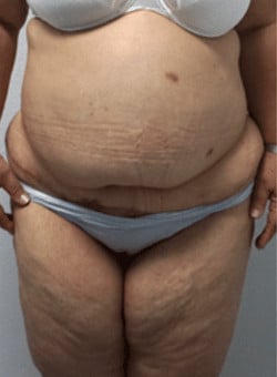 After Image
