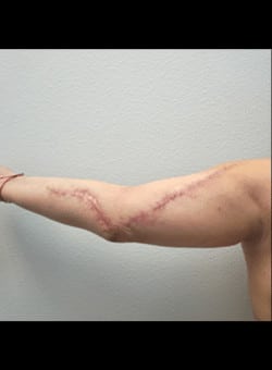 After Image