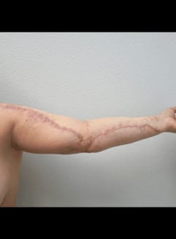 After Image