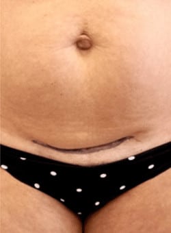 Before Image