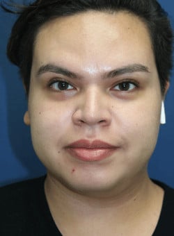 After Image
