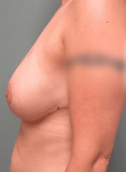 After Image