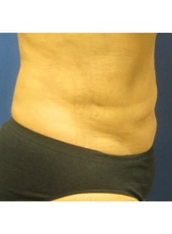 After Image