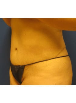 After Image