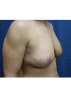 After Image