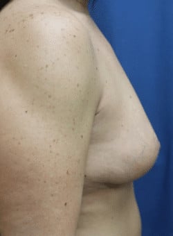 After Image